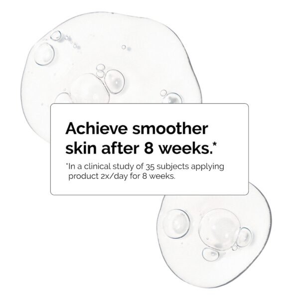 The Ordinary Niacinamide 10% + Zinc 1% Oil Control Serum - Image 5